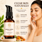Nirmal Varna Anti Pimple Gel