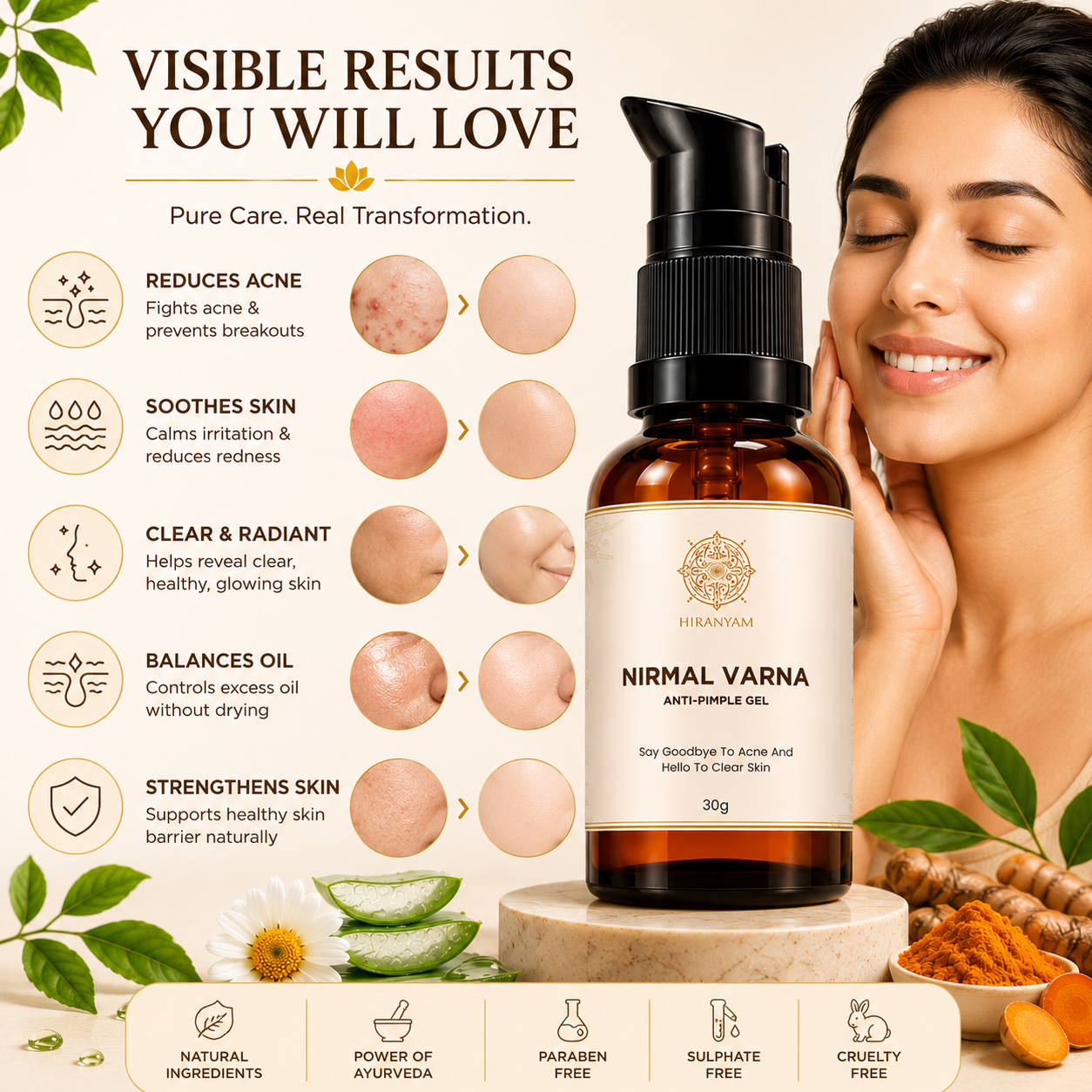 Nirmal Varna Anti Pimple Gel