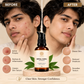 Nirmal Varna Anti-Pimple Gel bottle with Ayurvedic herbs and before/after images for acne treatment.