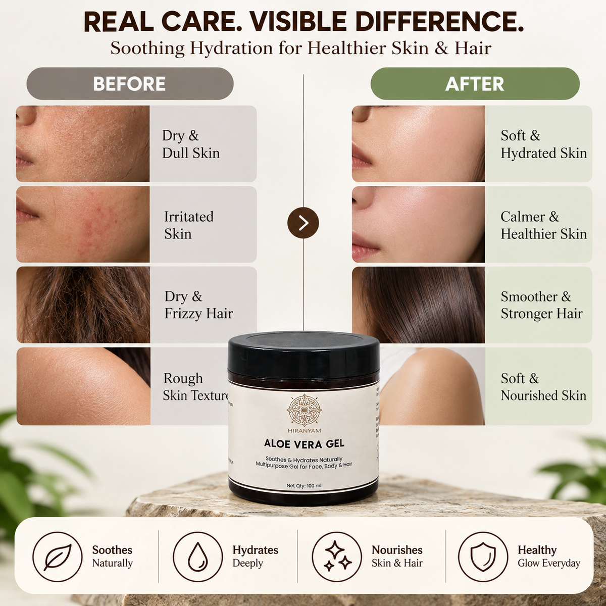 Aloe Vera Gel for Face & Hair | Hydrating Gel – 100ml